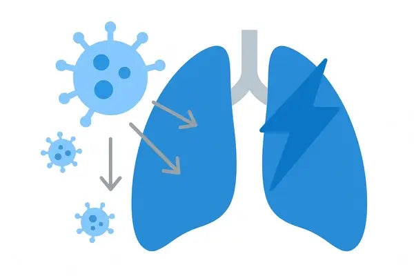 Pneumonia viral